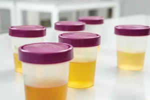 Urinalysis